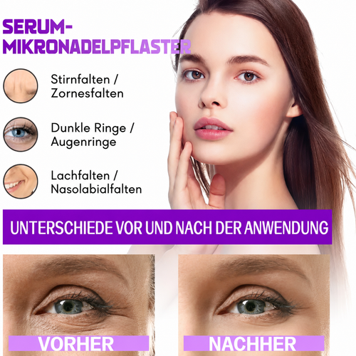 Mikronadel-Augenpads (30-TAGE-VORRAT)
